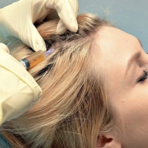 زراعة الشعر بتقنية الاقتطاف