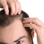 متى ينمو الشعر المزروع
