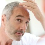 العمر المناسب لزراعة الشعر