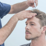 زراعة الشعر بدون حلاقة