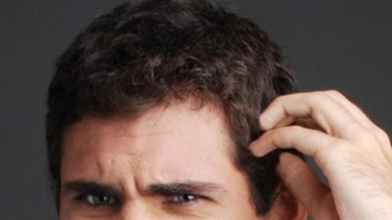 اسباب الحكة بعد زراعة الشعر