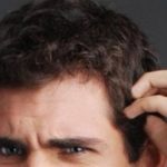 اسباب الحكة بعد زراعة الشعر