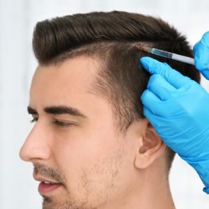 أقلام تشوي لزراعة الشعر في تركيا