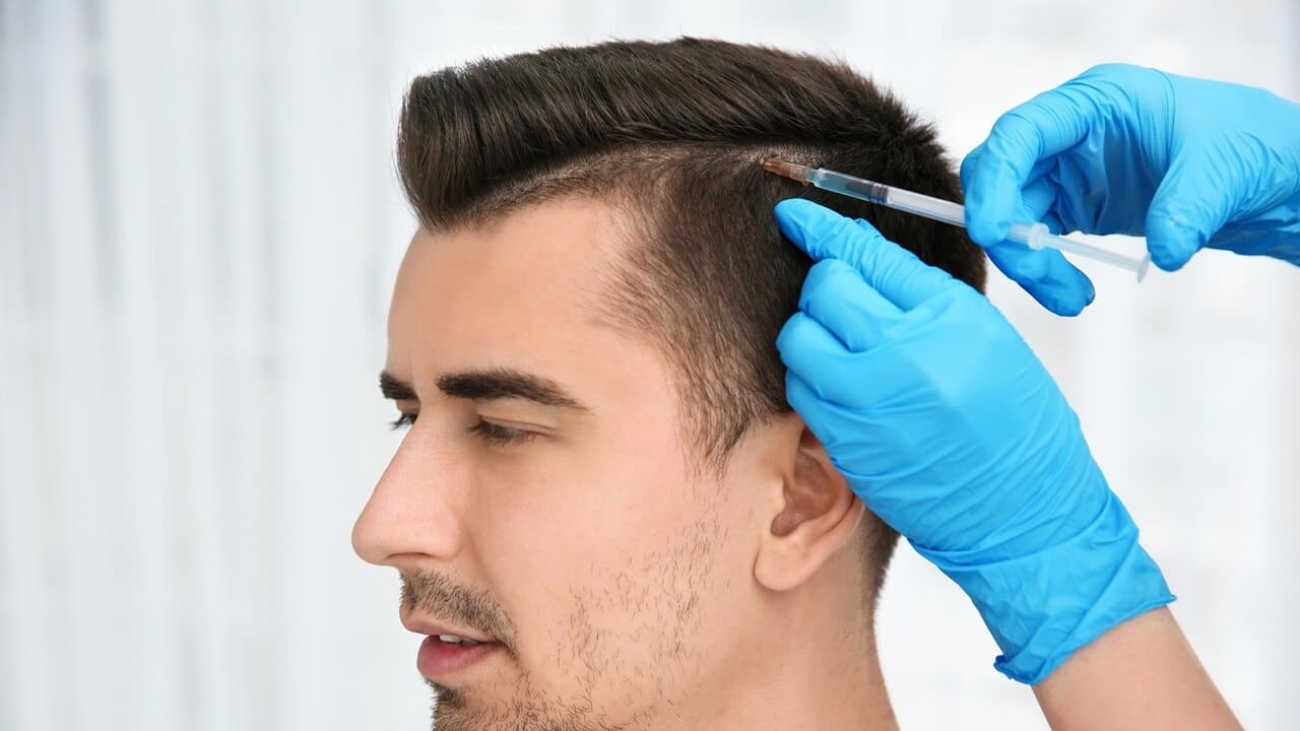 أفضل مركز لزراعة الشعر في تركيا