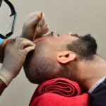 تكلفة زراعة الشعر