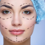 أسعار عمليات التجميل