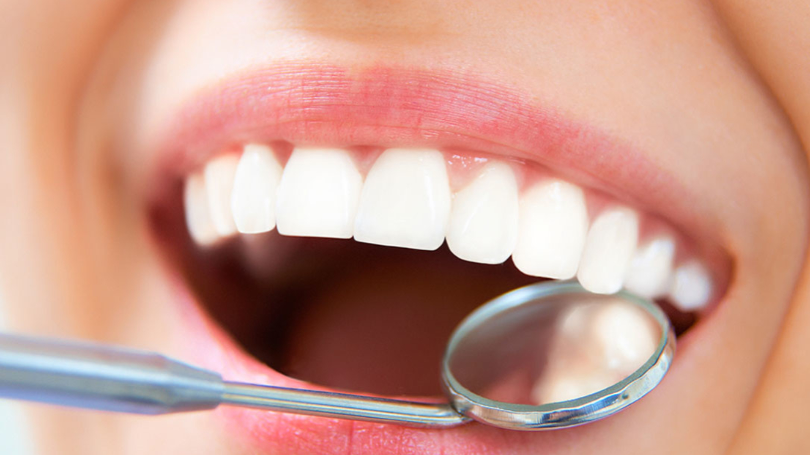 تجميل الأسنان في تركيا - احدث الطرق والتكاليف | Jawad Medical