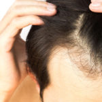 عملية زراعة الشعر في تركيا