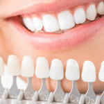 علاجات زراعة الأسنان