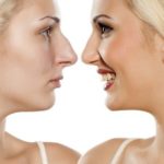 أنواع عمليات تجميل الأنف