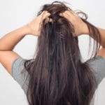 صبغ فروة الراس المجهري
