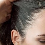 تكلفة زراعة الشعر في تركيا 2021