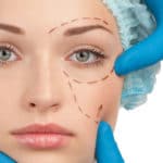 عملية تجميل الجفن