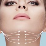 إزالة الذقن المزدوج