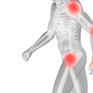 علاج ضمور العضلات في تركيا
