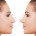 أسعار عمليات تجميل الوجه بالليزر