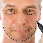 عمليات التجميل للرجال