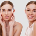 عملية تجميل الأذن بالخيوط
