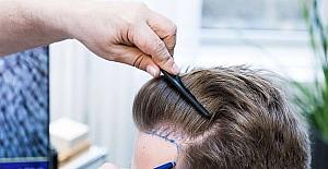 طرق عملية زراعة الشعر