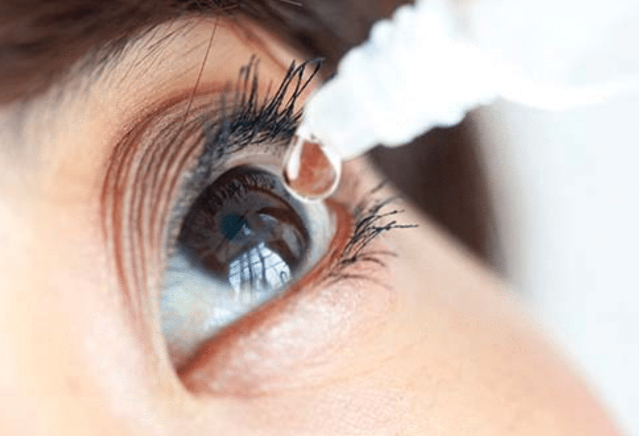 عملية ازالة الاكياس الدهنية تحت العين