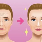 تقنية مورفيوس للوجه