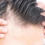 أفضل علاج لتساقط الشعر