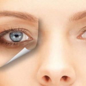 علاج الظلام تحت العينين وازالة الهالات السوداء حول العينين