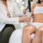 تجميل الشفرات بالليزر
