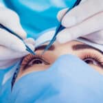 عمليات تجميل العيون