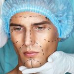 أسعار عمليات تجميل الوجه للرجال