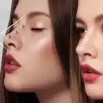 تجميل ارنبة الانف